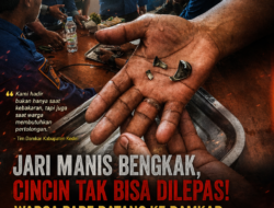 Jari Manis Bengkak, Cincin Tak Bisa Dilepas! Warga Pare Datang ke Damkar, Mini Grinder Jadi Penyelamat